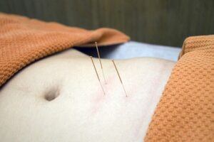 acupuncture-pour-la-menopause